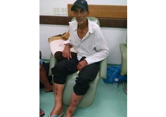 椅子で入院　ブラジル